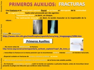 Una Fractura es la rotura total o parcial (fisura) de un hueso o interrupción de la continuidad
de un segmento óseo. Suele estar provocada por dos agentes:
.-Traumatismo directo, es decir, un choque.
.-Por contracción muscular, es decir, la acción muscular es la responsable de la
rotura .
Primeros Auxilios:Primeros Auxilios:Primeros Auxilios:Primeros Auxilios:
.. .- No mover antes de INMOVILIZARINMOVILIZAR la fractura.
http://www.seg-social.es/ism/gsanitaria_es/ilustr_capitulo7/cap7_6b_inmo_corporal.htm
.- Inmovilizar la fractura en la misma posición que la encontremos: NUNCANUNCA intentar realinearrealinear el miembro facturado.
.-Especial cuidado en fracturas de cráneo y columna vertebralcráneo y columna vertebral: no mover.
.- Solicitar ayuda sanitaria o trasladar a un centro sanitarioSolicitar ayuda sanitaria o trasladar a un centro sanitario de la forma más estable posible.
.-.- En fracturas compuestas o abiertascompuestas o abiertas, cubrir la herida con apósitos o pañuelos limpios, antes de inmovilizar (tener
presente el peligro de infección que conllevan estas fracturas).
TiposTipos de Fractura:Fractura:
http://www.nlm.nih.gov/medlineplus/spanish/ency/esp_imagepages/1096.htm
PrimerosAuxiliosAlonsoM.EscobarCorralEducaciónFísicaPrimerosAuxiliosAlonsoM.EscobarCorralEducaciónFísica
 