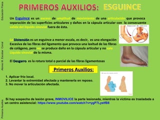 Un Esguince es un exceso de amplitud de movimiento de una articulación que provoca
separación de las superficies articulares y daños en la cápsula articular con la consecuente
salida del líquido sinovial fuera de ésta.
La DistensiónDistensión es un esguince a menor escala, es decir, es una elongación
Excesiva de las fibras del ligamento que provoca una laxitud de las fibras
de colágeno, pero no se produce daño en la cápsula articular y no sale
Líquido sinovial de la misma.
El DesgarroDesgarro es la rotura total o parcial de las fibras ligamentosas
Primeros Auxilios:Primeros Auxilios:
1. Aplicar frío local.
2. Levantar la extremidad afectada y mantenerla en reposo.
3. No mover la articulación afectada.
Si hay sospecha de lesión grave, INMOVILICE la parte lesionada, mientras la víctima es trasladada a
un centro asistencial: https://www.youtube.com/watch?v=ygP7LystfB8
PrimerosAuxiliosAlonsoM.EscobarCorralEducaciónFísicaPrimerosAuxiliosAlonsoM.EscobarCorralEducaciónFísica
 