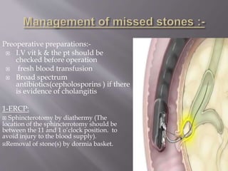 Preoperative preparations:-
 I.V vit k & the pt should be
checked before operation
 fresh blood transfusion
 Broad spectrum
antibiotics(cepholosporins ) if there
is evidence of cholangitis
1-ERCP:
 Sphincterotomy by diathermy (The
location of the sphincterotomy should be
between the 11 and 1 o’clock position. to
avoid injury to the blood supply).
Removal of stone(s) by dormia basket.
 