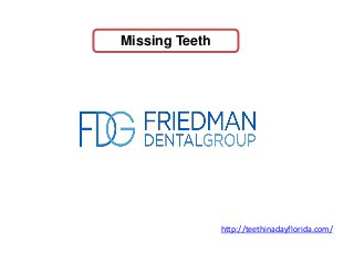 Missing Teeth
http://teethinadayflorida.com/
 