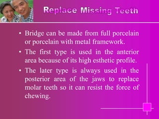 • Bridge can be made from full porcelain
  or porcelain with metal framework.
• The first type is used in the anterior
  area because of its high esthetic profile.
• The later type is always used in the
  posterior area of the jaws to replace
  molar teeth so it can resist the force of
  chewing.
 