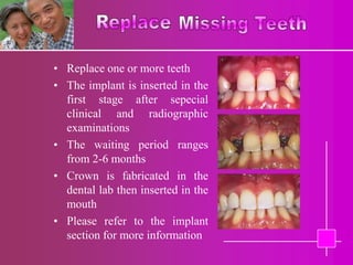 • Replace one or more teeth
• The implant is inserted in the
  first stage after sepecial
  clinical and radiographic
  examinations
• The waiting period ranges
  from 2-6 months
• Crown is fabricated in the
  dental lab then inserted in the
  mouth
• Please refer to the implant
  section for more information
 
