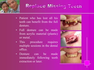 • Patient who has lost all his
  teeth can benefit from the full
  denture.
• Full denture can be made
  from acrylic material (plastic)
  or metal.
• This     procedure      requires
  multiple sessions in the dental
  office.
• Denture     can      be    made
  immediately following teeth
  extraction or later.
 