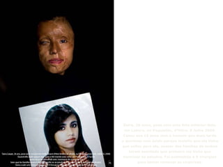 Saira, 26 anos, posa com uma foto anterior dela,
em Lahore, no Paquistão, 4ªfeira, 9 Julho 2008.
Casou aos 15 anos com o homem que mais tarde
a queimou com ácido porque insistia que ela tinha
que voltar para ele, apesar das famílias de ambos
terem acordado que primeiro ela tinha que
terminar os estudos. Foi submetida a 9 cirurgias
para tentar remover as cicatrizes.
 