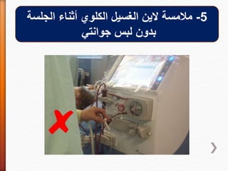 5-‫الجلسة‬ ‫أثناء‬ ‫الكلوي‬ ‫الغسيل‬ ‫الين‬ ‫مالمسة‬
‫جوانتي‬ ‫لبس‬ ‫بدون‬
 