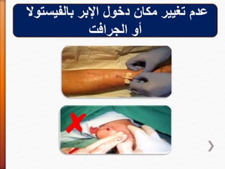 ‫عدم‬‫بالفيستوال‬ ‫اإلبر‬ ‫دخول‬ ‫مكان‬ ‫تغيير‬
‫أو‬‫الجرافت‬
 