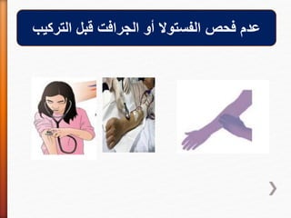 ‫عدم‬‫الجرافت‬ ‫أو‬ ‫الفستوال‬ ‫فحص‬‫التركيب‬ ‫قبل‬
 