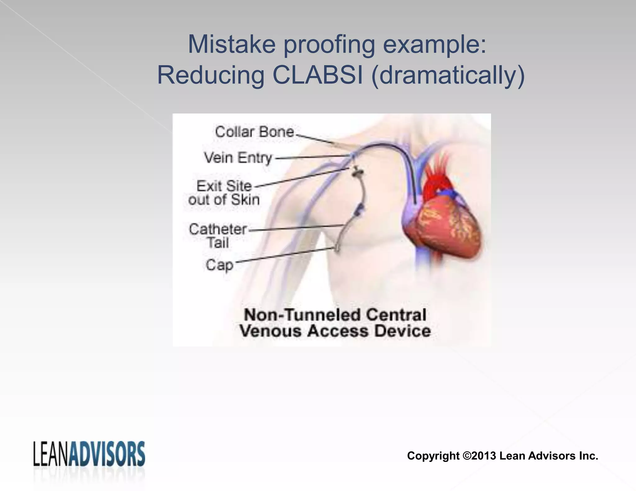 Mistake proofing example:
Reducing CLABSI (dramatically)
Copyright ©2013 Lean Advisors Inc.
 