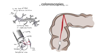…, colonoscopies, …
 