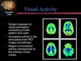 Visual Activity <ul><li>Subject exposed to visual stimulation consisting of both pattern and color. </li></ul><ul><li>Incr...