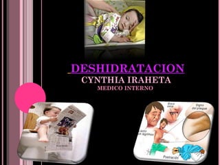   DESHIDRATACION CYNTHIA IRAHETA MEDICO INTERNO  