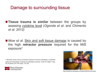 10
 Tissue trauma is similar between the groups by
assesing cytokine level (Ogonda et al. and Chimento
et al. 2012)
 Mow et al. Skin and soft tissue damage is caused by
the high retractor pressure required for the MIS
exposure1
Damage to surrounding tissue
http://emedicine.medscape.com/article/2000333-technique
1. Minimally invasive versus conventional exposure for total hip arthroplasty: a systematic
review and meta-analysis of clinical and radiological outcomes. Smith TO, Blake V, Hing
CB. Int Orthop. 2011 Feb; 35(2): 173–184.
 