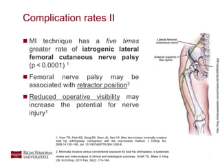 14
Complication rates II
 MI technique has a five times
greater rate of iatrogenic lateral
femoral cutaneous nerve palsy
(p < 0.0001) 1
 Femoral nerve palsy may be
associated with retractor position2
 Reduced operative visibility may
increase the potential for nerve
injury1
1. Yoon TR, Park KS, Song EK, Seon JK, Seo HY. New two-incision minimally invasive
total hip arthroplasty: comparison with the one-incision method. J Orthop Sci.
2009;14:155–160. doi: 10.1007/s00776-008-1305-8.
2. Minimally invasive versus conventional exposure for total hip arthroplasty: a systematic
review and meta-analysis of clinical and radiological outcomes. Smith TO, Blake V, Hing
CB. Int Orthop. 2011 Feb; 35(2): 173–184.
http://img.medscapestatic.com/pi/meds/ckb/54/29654tn.jpg
 