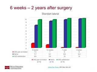 16
6 weeks – 2 years after surgery
0
1
2
3
4
5
6
7
8
9
10
6 weeks 12 weeks 1 year 2 years
VAS pain at motion 1.5 1 0 0
Harris 7.7 9.1 9.6 9.9
VAS satisfaction 9.6 9.6 10 10
Standart lateral
VAS pain at motion Harris VAS satisfaction
Orthop Rev (Pavia). 2013 Dec; 5(4): e31.
[0-10] [0-10] [0-10]
 