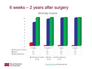 17
0
1
2
3
4
5
6
7
8
9
10
6 weeks 12 weeks 1 year 2 years
VAS pain at motion 1 0 0 0
Harris 8.3 9.5 9.9 9.9
VAS satisfaction 10 10 10 10
Minimally invasive
VAS pain at motion Harris VAS satisfaction
6 weeks – 2 years after surgery
Orthop Rev (Pavia). 2013 Dec; 5(4): e31.
[0-10] [0-10] [0-10]
 