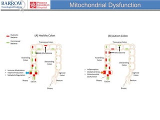 Mitochondrial Dysfunction
 