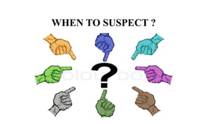 WHEN TO SUSPECT ?
 