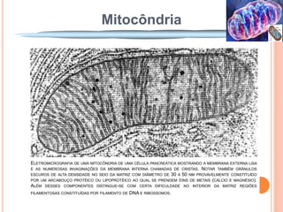 Mitocôndria                      Mitocôndria




   ELETROMICROGRAFIA DE UMA MITOCÔNDRIA DE UMA CÉLULA PANCREÁTICA MOSTRANDO A MEMBRANA EXTERNA LISA
   E AS NUMEROSAS INVAGINAÇÕES DA MEMBRANA INTERNA CHAMADAS DE CRISTAS. NOTAR TAMBÉM GRÂNULOS
   ESCUROS DE ALTA DENSIDADE NO SEIO DA MATRIZ COM DIÂMETRO DE 30 A 50 NM PROVAVELMENTE CONSTITUÍDO
   POR UM ARCABOUÇO PROTÉICO OU LIPOPROTÉICO AO QUAL SE PRENDEM ÍONS DE METAIS (CÁLCIO E MAGNÉSIO).
   ALÉM DESSES COMPONENTES DISTINGUE-SE COM CERTA DIFICULDADE NO INTERIOR DA MATRIZ REGIÕES
   FILAMENTOSAS CONSTITUÍDAS POR FILAMENTO DE   DNA E RIBOSSOMOS.
 