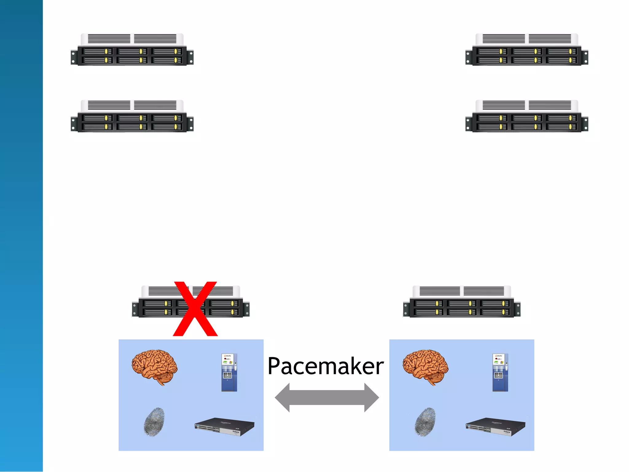 X   Pacemaker
 
