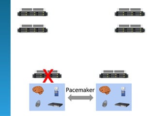 X   Pacemaker
 
