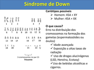 3 cromossomos no par 21
Trissomia
Cariótipos possíveis
 Homem: 45A + XY
 Mulher: 45A + XX
O que causa?
Erro na distribuição dos
cromossomos na formação dos
gametas (espermatozóides ou
óvulos)
 Idade avançada
 Exposição a altas taxas de
radiação
 Uso de drogas alucinógenas
(LSD, Heroína, Ecstasy)
Uso de bebidas alcoólicas e
cigarros.
Síndrome de Down
 