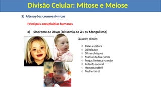 3) Alterações cromossômicas
Principais aneuploidias humanas
a) Síndrome de Down (Trissomia do 21 ou Mongolismo)
Quadro clínico
o Baixa estatura
o Obesidade
o Olhos oblíquos
o Mãos e dedos curtos
o Prega Simiesca na mão
o Retardo mental
o Homem estéril
o Mulher fértil
Divisão Celular: Mitose e Meiose
Divisão Celular: Mitose e Meiose
 