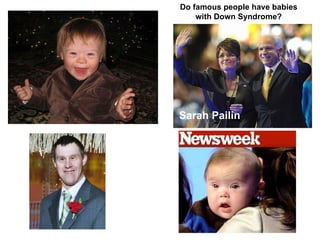 Sarah Pailin Do famous people have babies with Down Syndrome? 