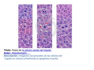 Título:Fases de la mitosis celular del hígado  Autor:Vetpathologist Descripción:Imágenes secuenciales de las células del  hígado en mitosis y,finalmente,la apoptosis muerte)  