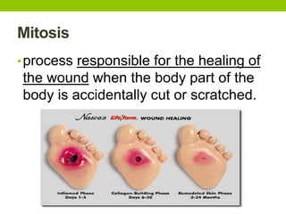 Mitosis
•process responsible for the healing of
the wound when the body part of the
body is accidentally cut or scratched.
 