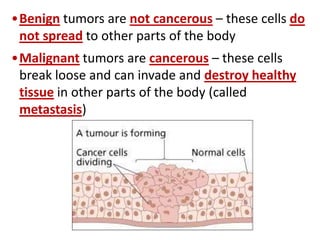 •Benign tumors are not cancerous – these cells do
not spread to other parts of the body
•Malignant tumors are cancerous – these cells
break loose and can invade and destroy healthy
tissue in other parts of the body (called
metastasis)
 