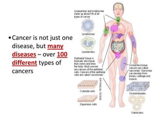 •Cancer is not just one
disease, but many
diseases – over 100
different types of
cancers
 