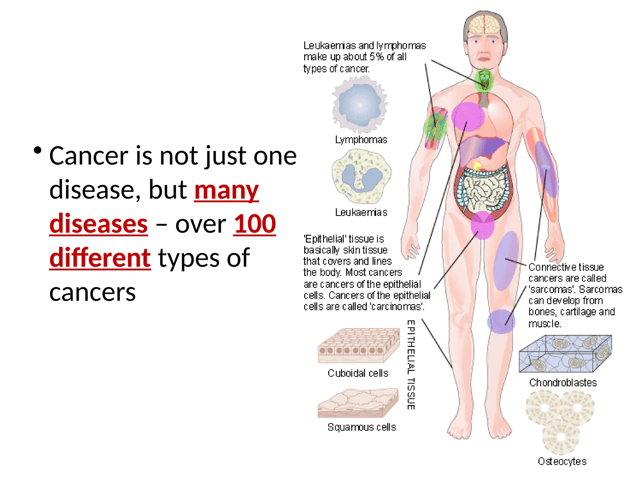 • Cancer is not just one
disease, but many
diseases – over 100
different types of
cancers
 