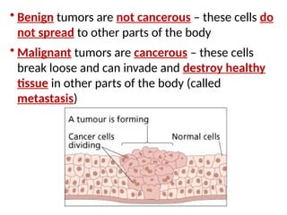 • Benign tumors are not cancerous – these cells do
not spread to other parts of the body
• Malignant tumors are cancerous – these cells
break loose and can invade and destroy healthy
tissue in other parts of the body (called
metastasis)
 