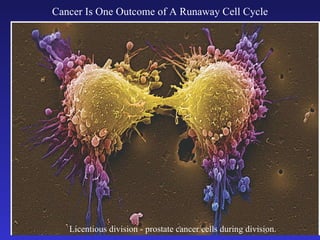 Cancer Is One Outcome of A Runaway Cell Cycle Licentious division - prostate cancer cells during division.  