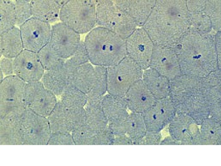 mitosis animal plant best best best 1