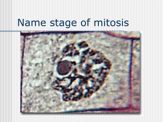 Name stage of mitosis
 
