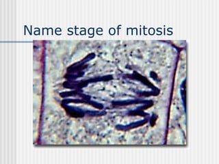 Name stage of mitosis
 