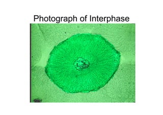 Photograph of Interphase
 