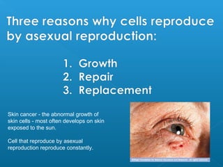 Skin cancer - the abnormal growth of
skin cells - most often develops on skin
exposed to the sun.
Cell that reproduce by asexual
reproduction reproduce constantly.
 