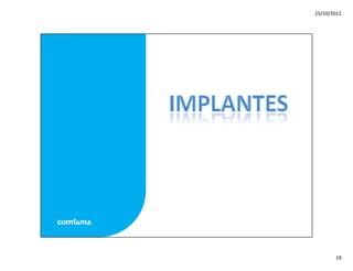 Mitos y realidades anticoncepcion