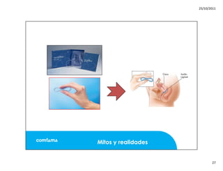 Mitos y realidades anticoncepcion