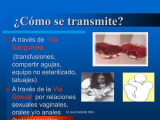 EL SALVADOR 2003
¿Cómo se transmite?
 A través de Vía
Sanguínea.
(transfusiones,
compartir agujas,
equipo no esterilizado,
tatuajes)
 A través de la Vía
Sexual por relaciones
sexuales vaginales,
orales y/o anales
 