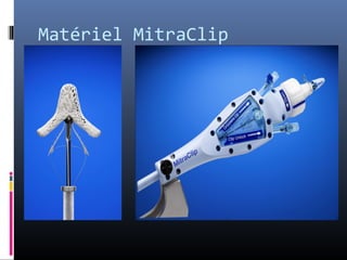 Matériel MitraClip 
 