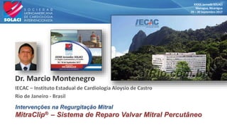 XXXIII Jornada SOLACI
Managua, Nicarágua
29 – 30 Septembro 2017
Intervenções na Regurgitação Mitral
MitraClip® ‒ Sistema de Reparo Valvar Mitral Percutâneo
 