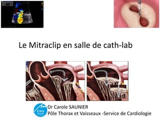 Le Mitraclip en salle de cath-lab
Dr Carole SAUNIER
Pôle Thorax et Vaisseaux -Service de Cardiologie
 