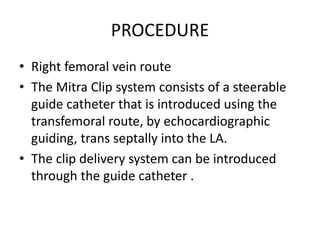 PROCEDURE
• Right femoral vein route
• The Mitra Clip system consists of a steerable
guide catheter that is introduced using the
transfemoral route, by echocardiographic
guiding, trans septally into the LA.
• The clip delivery system can be introduced
through the guide catheter .
 