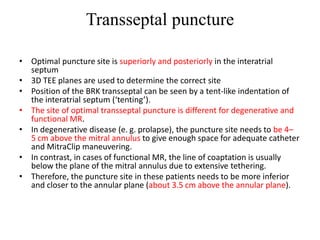 Transseptal puncture
• Optimal puncture site is superiorly and posteriorly in the interatrial
septum
• 3D TEE planes are used to determine the correct site
• Position of the BRK transseptal can be seen by a tent-like indentation of
the interatrial septum (‘tenting’).
• The site of optimal transseptal puncture is different for degenerative and
functional MR.
• In degenerative disease (e. g. prolapse), the puncture site needs to be 4–
5 cm above the mitral annulus to give enough space for adequate catheter
and MitraClip maneuvering.
• In contrast, in cases of functional MR, the line of coaptation is usually
below the plane of the mitral annulus due to extensive tethering.
• Therefore, the puncture site in these patients needs to be more inferior
and closer to the annular plane (about 3.5 cm above the annular plane).
 