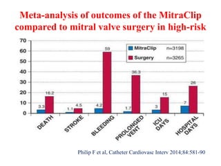Meta-analysis of outcomes of the MitraClip
compared to mitral valve surgery in high-risk
Philip F et al, Catheter Cardiovasc Interv 2014;84:581-90
 
