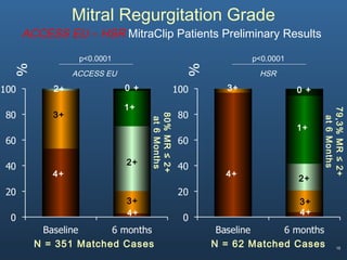 15
Mitral Regurgitation Grade
ACCESS EU – HSR MitraClip Patients Preliminary Results
80%MR≤2+
at6Months
3+
4+
3+
2+
1+
0 +
p<0.0001
N = 351 Matched Cases
2+
4+
79,3%MR≤2+
at6Months
3+
4+
3+
2+
1+
0 +
p<0.0001
ACCESS EU HSR
N = 62 Matched Cases
4+
 