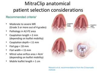 MitraClip anatomical
patient selection considerations
• Moderate to severe MR
(Grade 3 or more out of 4 grades)
• Pathology in A2-P2 area
• Coaptation length > 2 mm
(depending on leaflet mobility)
• Coaptation depth < 11 mm
• Flail gap < 10 mm
• Flail width < 15 mm
• Mitral valve orifice area > 4cm2
(depending on leaflet mobility)
• Mobile leaflet length > 1 cm
Recommended criteria1
Maisano et al, recommendations from the Crossroads
institute.
 